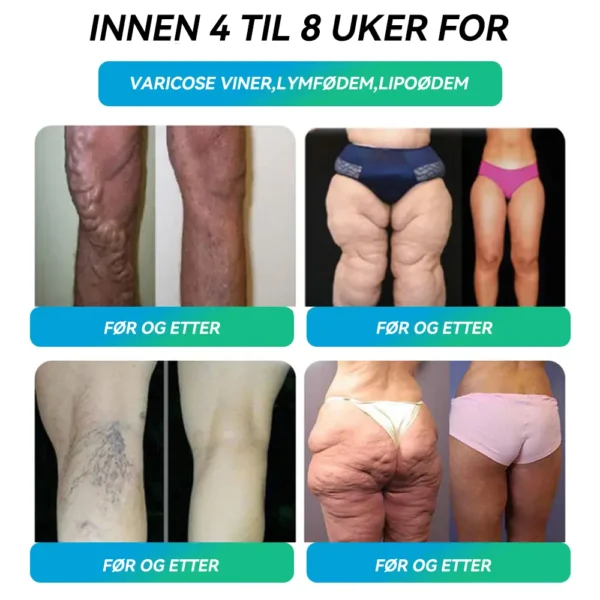 𝑶𝒇𝒇𝒊𝒄𝒊𝒂𝒍 𝑺𝒕𝒐𝒓𝒆  | 𝑯𝑯𝑽𝑩®💖𝐺𝐿𝑃-𝟏  Seks-i-én helseløsning som munnvæske (Kun én gang i uken – synlige resultater på 7 dager） ✅  For overvekt, hjerte- og karhelse, diabetes, søvnapné, leddplager og mer