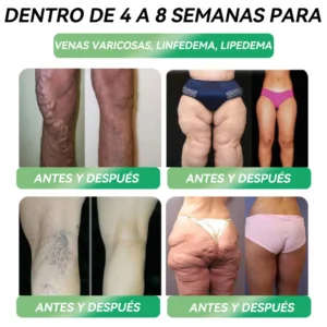 Tienda Oficial | 𝙃𝐻𝑉𝖡®🌿🌿𝐺𝐿𝑃-𝟏 𝑆𝑖𝑥 𝑖𝑛-𝑂𝑛𝑒 𝑆𝑜𝑙𝑢𝑐𝑖𝑜𝑛 𝑜𝑟𝑎𝑙 𝑙𝑖𝑞𝑢𝑖𝑑𝑎 (Solo una dosis al día, cambios visibles en 7 días) ✅ Para obesidad, salud cardiovascular, diabetes, apnea del sueño, problemas articulares y más.