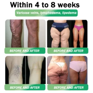 🇺🇸𝑶𝒇𝒇𝒊𝒄𝒊𝒂𝒍 𝑺𝒕𝒐𝒓𝒆|🏆🔥HH𝐕𝐁® 𝐍𝐀𝐃+ 𝐆𝐋𝐏-𝟏 Pro ALL-IN-ONE Fit&Vital 𝐎𝐫𝐚𝐥 𝐋𝐢𝐪𝐮𝐢𝐝 (𝐉𝐮𝐬𝐭 𝐨𝐧𝐜𝐞 𝐚 𝐝𝐚𝐲, 𝐯𝐢𝐬𝐢𝐛𝐥𝐞 𝐜𝐡𝐚𝐧𝐠𝐞𝐬 𝐢𝐧 𝟕 𝐝𝐚𝐲𝐬） ✅ 𝐅𝐨𝐫 𝐨𝐛𝐞𝐬𝐢𝐭𝐲, 𝐜𝐚𝐫𝐝𝐢𝐨𝐯𝐚𝐬𝐜𝐮𝐥𝐚𝐫 𝐡𝐞𝐚𝐥𝐭𝐡, 𝐝𝐢𝐚𝐛𝐞𝐭𝐞𝐬, 𝐬𝐥𝐞𝐞𝐩 𝐚𝐩𝐧𝐞𝐚, 𝐆𝐮𝐭 𝐇𝐞𝐚𝐥𝐭𝐡, 𝐣𝐨𝐢𝐧𝐭 𝐢𝐬𝐬𝐮𝐞𝐬, 𝐚𝐧𝐝 𝐦𝐨𝐫𝐞