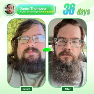 🇺🇸𝑶𝒇𝒇𝒊𝒄𝒊𝒂𝒍 𝑺𝒕𝒐𝒓𝒆|🏆🔥HH𝐕𝐁® 𝐍𝐀𝐃+ 𝐆𝐋𝐏-𝟏 Pro ALL-IN-ONE Fit&Vital 𝐎𝐫𝐚𝐥 𝐋𝐢𝐪𝐮𝐢𝐝 (𝐉𝐮𝐬𝐭 𝐨𝐧𝐜𝐞 𝐚 𝐝𝐚𝐲, 𝐯𝐢𝐬𝐢𝐛𝐥𝐞 𝐜𝐡𝐚𝐧𝐠𝐞𝐬 𝐢𝐧 𝟕 𝐝𝐚𝐲𝐬） ✅ 𝐅𝐨𝐫 𝐨𝐛𝐞𝐬𝐢𝐭𝐲, 𝐜𝐚𝐫𝐝𝐢𝐨𝐯𝐚𝐬𝐜𝐮𝐥𝐚𝐫 𝐡𝐞𝐚𝐥𝐭𝐡, 𝐝𝐢𝐚𝐛𝐞𝐭𝐞𝐬, 𝐬𝐥𝐞𝐞𝐩 𝐚𝐩𝐧𝐞𝐚, 𝐆𝐮𝐭 𝐇𝐞𝐚𝐥𝐭𝐡, 𝐣𝐨𝐢𝐧𝐭 𝐢𝐬𝐬𝐮𝐞𝐬, 𝐚𝐧𝐝 𝐦𝐨𝐫𝐞