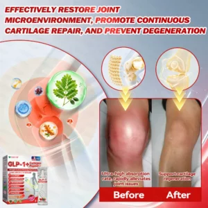 𝗢𝗳𝗳𝗶𝗰𝗶𝗮𝗹 𝐒𝐭𝐨𝐫𝐞 🇺🇲 | 𝐇𝐇𝑽𝑩® 𝐆𝑳𝗣-𝟭 + 𝐂𝐨𝐥𝐥𝗮𝗴𝗲𝗻 𝐏𝐞𝐩𝘁𝗶𝗱𝗲𝘀 𝐖𝐞𝐢𝗴𝗵𝘁 𝐋𝐨𝐬𝐬 & 𝗙𝗶𝗿𝗺𝗶𝗻𝗴 𝐎𝐫𝐚𝒍 𝐒𝐨𝐥𝐮𝒕𝒊𝒐𝒏 💫 𝐖𝐢𝐭𝐡 𝐂𝐨𝐥𝐥𝗮𝗴𝗲𝗻 𝐏𝐞𝐩𝘁𝗶𝗱𝗲𝘀 & 𝐌𝐚𝐭𝐫𝐢𝒙𝒚𝒍 𝟑𝟎𝟎𝟎 — 𝐡𝐞𝐥𝐩𝐬 𝐭𝐚𝐫𝐠𝐞𝐭 𝐨𝐛𝐞𝐬𝐢𝐭𝐲, 𝐟𝐢𝐫𝐦 𝐭𝐡𝐞 𝐬𝐤𝐢𝐧, 𝐚𝐧𝐝 𝐬𝐮𝐩𝐩𝐨𝐫𝐭 𝐡𝐞𝐚𝐫𝐭 𝐡𝐞𝐚𝐥𝐭𝐡, 𝐛𝐥𝐨𝐨𝐝 𝐬𝐮𝐠𝐚𝐫 𝐛𝐚𝐥𝐚𝐧𝐜𝐞, 𝐬𝐥𝐞𝐞𝐩 𝐪𝐮𝐚𝐥𝐢𝐭𝐲, 𝐚𝐧𝐝 𝐣𝐨𝐢𝐧𝐭 𝐦𝐨𝐛𝐢𝐥𝐢𝐭𝐲