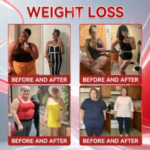 𝗢𝗳𝗳𝗶𝗰𝗶𝗮𝗹 𝐒𝐭𝐨𝐫𝐞 🇺🇲 | 𝐇𝐇𝑽𝑩® 𝐆𝑳𝗣-𝟭 + 𝐂𝐨𝐥𝐥𝗮𝗴𝗲𝗻 𝐏𝐞𝐩𝘁𝗶𝗱𝗲𝘀 𝐖𝐞𝐢𝗴𝗵𝘁 𝐋𝐨𝐬𝐬 & 𝗙𝗶𝗿𝗺𝗶𝗻𝗴 𝐎𝐫𝐚𝒍 𝐒𝐨𝐥𝐮𝒕𝒊𝒐𝒏 💫 𝐖𝐢𝐭𝐡 𝐂𝐨𝐥𝐥𝗮𝗴𝗲𝗻 𝐏𝐞𝐩𝘁𝗶𝗱𝗲𝘀 & 𝐌𝐚𝐭𝐫𝐢𝒙𝒚𝒍 𝟑𝟎𝟎𝟎 — 𝐡𝐞𝐥𝐩𝐬 𝐭𝐚𝐫𝐠𝐞𝐭 𝐨𝐛𝐞𝐬𝐢𝐭𝐲, 𝐟𝐢𝐫𝐦 𝐭𝐡𝐞 𝐬𝐤𝐢𝐧, 𝐚𝐧𝐝 𝐬𝐮𝐩𝐩𝐨𝐫𝐭 𝐡𝐞𝐚𝐫𝐭 𝐡𝐞𝐚𝐥𝐭𝐡, 𝐛𝐥𝐨𝐨𝐝 𝐬𝐮𝐠𝐚𝐫 𝐛𝐚𝐥𝐚𝐧𝐜𝐞, 𝐬𝐥𝐞𝐞𝐩 𝐪𝐮𝐚𝐥𝐢𝐭𝐲, 𝐚𝐧𝐝 𝐣𝐨𝐢𝐧𝐭 𝐦𝐨𝐛𝐢𝐥𝐢𝐭𝐲