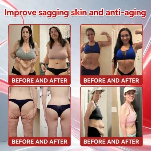 𝗢𝗳𝗳𝗶𝗰𝗶𝗮𝗹 𝐒𝐭𝐨𝐫𝐞 🇺🇲 | 𝐇𝐇𝑽𝑩® 𝐆𝑳𝗣-𝟭 + 𝐂𝐨𝐥𝐥𝗮𝗴𝗲𝗻 𝐏𝐞𝐩𝘁𝗶𝗱𝗲𝘀 𝐖𝐞𝐢𝗴𝗵𝘁 𝐋𝐨𝐬𝐬 & 𝗙𝗶𝗿𝗺𝗶𝗻𝗴 𝐎𝐫𝐚𝒍 𝐒𝐨𝐥𝐮𝒕𝒊𝒐𝒏 💫 𝐖𝐢𝐭𝐡 𝐂𝐨𝐥𝐥𝗮𝗴𝗲𝗻 𝐏𝐞𝐩𝘁𝗶𝗱𝗲𝘀 & 𝐌𝐚𝐭𝐫𝐢𝒙𝒚𝒍 𝟑𝟎𝟎𝟎 — 𝐡𝐞𝐥𝐩𝐬 𝐭𝐚𝐫𝐠𝐞𝐭 𝐨𝐛𝐞𝐬𝐢𝐭𝐲, 𝐟𝐢𝐫𝐦 𝐭𝐡𝐞 𝐬𝐤𝐢𝐧, 𝐚𝐧𝐝 𝐬𝐮𝐩𝐩𝐨𝐫𝐭 𝐡𝐞𝐚𝐫𝐭 𝐡𝐞𝐚𝐥𝐭𝐡, 𝐛𝐥𝐨𝐨𝐝 𝐬𝐮𝐠𝐚𝐫 𝐛𝐚𝐥𝐚𝐧𝐜𝐞, 𝐬𝐥𝐞𝐞𝐩 𝐪𝐮𝐚𝐥𝐢𝐭𝐲, 𝐚𝐧𝐝 𝐣𝐨𝐢𝐧𝐭 𝐦𝐨𝐛𝐢𝐥𝐢𝐭𝐲