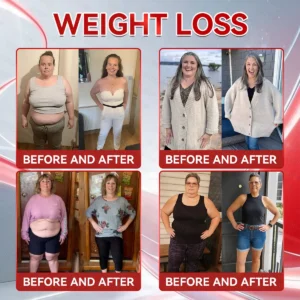 𝗢𝗳𝗳𝗶𝗰𝗶𝗮𝗹 𝐒𝐭𝐨𝐫𝐞 🇺🇲 | 𝐇𝐇𝑽𝑩® 𝐆𝑳𝗣-𝟭 + 𝐂𝐨𝐥𝐥𝗮𝗴𝗲𝗻 𝐏𝐞𝐩𝘁𝗶𝗱𝗲𝘀 𝐖𝐞𝐢𝗴𝗵𝘁 𝐋𝐨𝐬𝐬 & 𝗙𝗶𝗿𝗺𝗶𝗻𝗴 𝐎𝐫𝐚𝒍 𝐒𝐨𝐥𝐮𝒕𝒊𝒐𝒏 💫 𝐖𝐢𝐭𝐡 𝐂𝐨𝐥𝐥𝗮𝗴𝗲𝗻 𝐏𝐞𝐩𝘁𝗶𝗱𝗲𝘀 & 𝐌𝐚𝐭𝐫𝐢𝒙𝒚𝒍 𝟑𝟎𝟎𝟎 — 𝐡𝐞𝐥𝐩𝐬 𝐭𝐚𝐫𝐠𝐞𝐭 𝐨𝐛𝐞𝐬𝐢𝐭𝐲, 𝐟𝐢𝐫𝐦 𝐭𝐡𝐞 𝐬𝐤𝐢𝐧, 𝐚𝐧𝐝 𝐬𝐮𝐩𝐩𝐨𝐫𝐭 𝐡𝐞𝐚𝐫𝐭 𝐡𝐞𝐚𝐥𝐭𝐡, 𝐛𝐥𝐨𝐨𝐝 𝐬𝐮𝐠𝐚𝐫 𝐛𝐚𝐥𝐚𝐧𝐜𝐞, 𝐬𝐥𝐞𝐞𝐩 𝐪𝐮𝐚𝐥𝐢𝐭𝐲, 𝐚𝐧𝐝 𝐣𝐨𝐢𝐧𝐭 𝐦𝐨𝐛𝐢𝐥𝐢𝐭𝐲