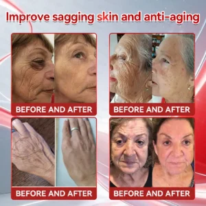 𝗢𝗳𝗳𝗶𝗰𝗶𝗮𝗹 𝐒𝐭𝐨𝐫𝐞 🇺🇲 | 𝐇𝐇𝑽𝑩® 𝐆𝑳𝗣-𝟭 + 𝐂𝐨𝐥𝐥𝗮𝗴𝗲𝗻 𝐏𝐞𝐩𝘁𝗶𝗱𝗲𝘀 𝐖𝐞𝐢𝗴𝗵𝘁 𝐋𝐨𝐬𝐬 & 𝗙𝗶𝗿𝗺𝗶𝗻𝗴 𝐎𝐫𝐚𝒍 𝐒𝐨𝐥𝐮𝒕𝒊𝒐𝒏 💫 𝐖𝐢𝐭𝐡 𝐂𝐨𝐥𝐥𝗮𝗴𝗲𝗻 𝐏𝐞𝐩𝘁𝗶𝗱𝗲𝘀 & 𝐌𝐚𝐭𝐫𝐢𝒙𝒚𝒍 𝟑𝟎𝟎𝟎 — 𝐡𝐞𝐥𝐩𝐬 𝐭𝐚𝐫𝐠𝐞𝐭 𝐨𝐛𝐞𝐬𝐢𝐭𝐲, 𝐟𝐢𝐫𝐦 𝐭𝐡𝐞 𝐬𝐤𝐢𝐧, 𝐚𝐧𝐝 𝐬𝐮𝐩𝐩𝐨𝐫𝐭 𝐡𝐞𝐚𝐫𝐭 𝐡𝐞𝐚𝐥𝐭𝐡, 𝐛𝐥𝐨𝐨𝐝 𝐬𝐮𝐠𝐚𝐫 𝐛𝐚𝐥𝐚𝐧𝐜𝐞, 𝐬𝐥𝐞𝐞𝐩 𝐪𝐮𝐚𝐥𝐢𝐭𝐲, 𝐚𝐧𝐝 𝐣𝐨𝐢𝐧𝐭 𝐦𝐨𝐛𝐢𝐥𝐢𝐭𝐲