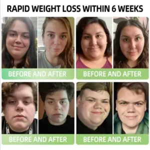 𝑯𝑯𝑽𝑩® 𝑵𝑰𝑫𝑫𝑲-𝑻𝒊𝒓𝒛𝒆𝒑𝒂𝒕𝒊𝒅𝒆 𝑵𝒂𝒏𝒐 𝑴𝒊𝒄𝒓𝒐𝒏𝒆𝒆𝒅𝒍𝒆 𝑷𝒂𝒕𝒄𝒉